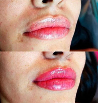 antes-e-depois-labial01